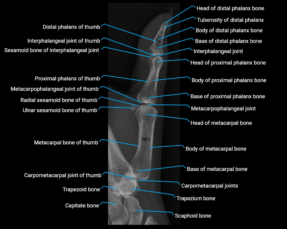 x ray thumb lateral labelled anatomy image.webp